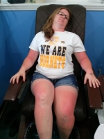 A very burned cousin Kathy